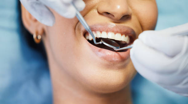 Best Broken or Cracked Tooth Emergency Dentist in Prince Frederick, MD