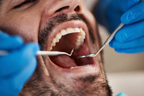 Best Pediatric Emergency Dentist in Prince Frederick, MD